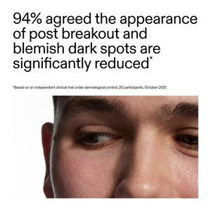 Advertisement showing a close-up of a person's face with text about dark spot reduction after using Mandelic Acid Treatment
