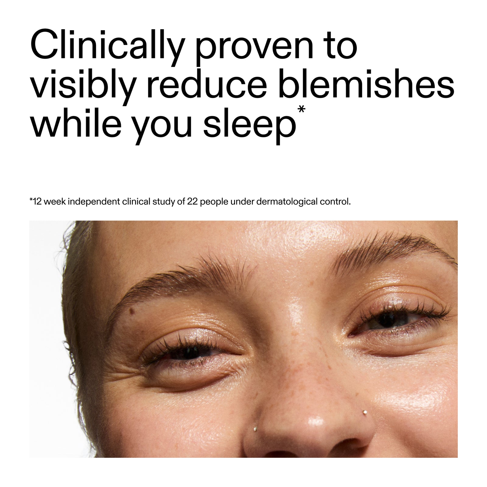 Advertisement for Blemish Clearing Moisturizer with 2% Novoretin showing a close-up of a person's eye with text claiming clinical provenance.