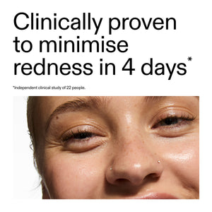 Close-up of a person's eye with text claiming clinical provenance of Azelaic Acid Serum  to help minimize redness in 4 days.