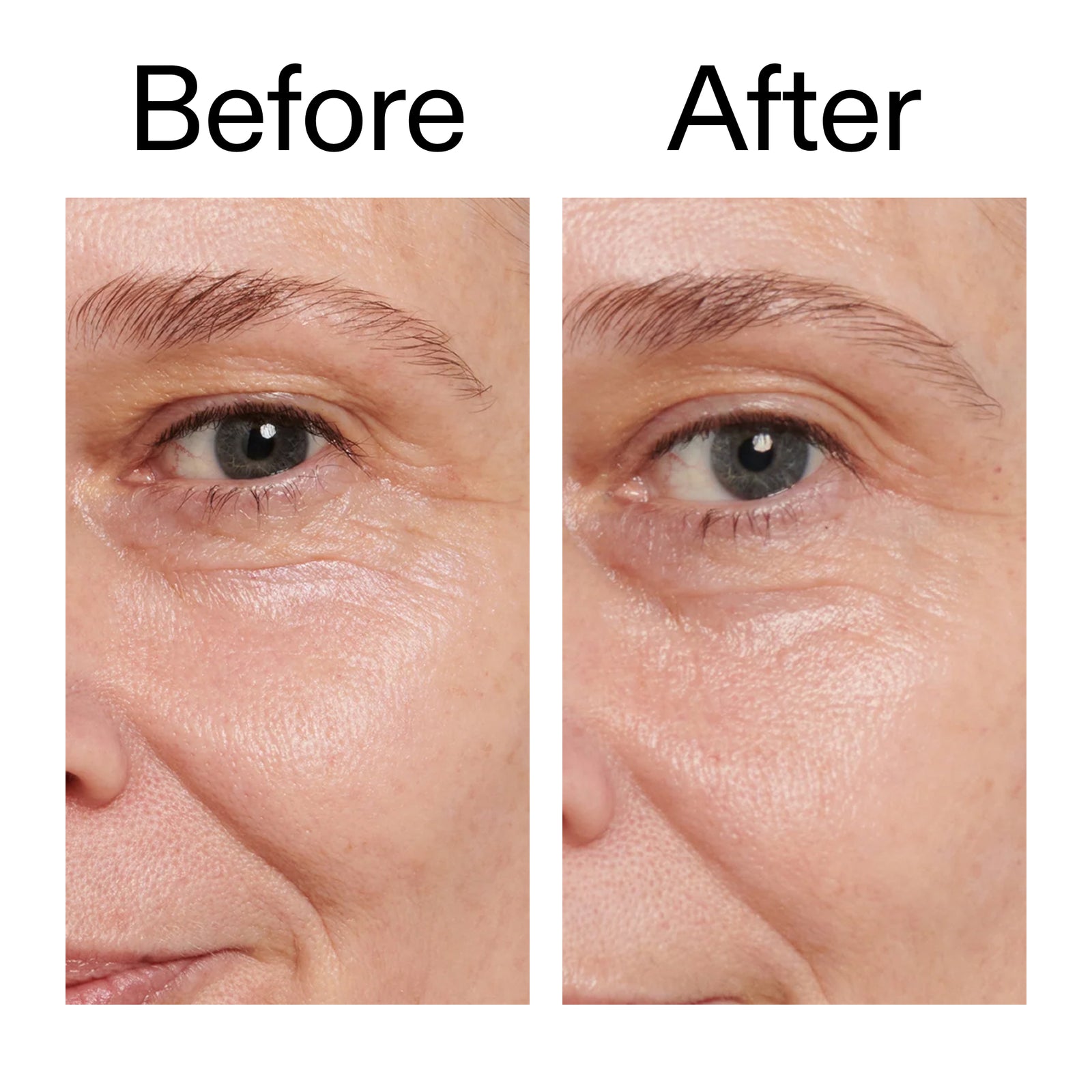 Before and after using Retinol Eye Cream