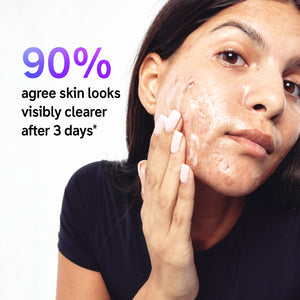 Model applying Supersize Salicylic Acid Cleanser with the statistic 