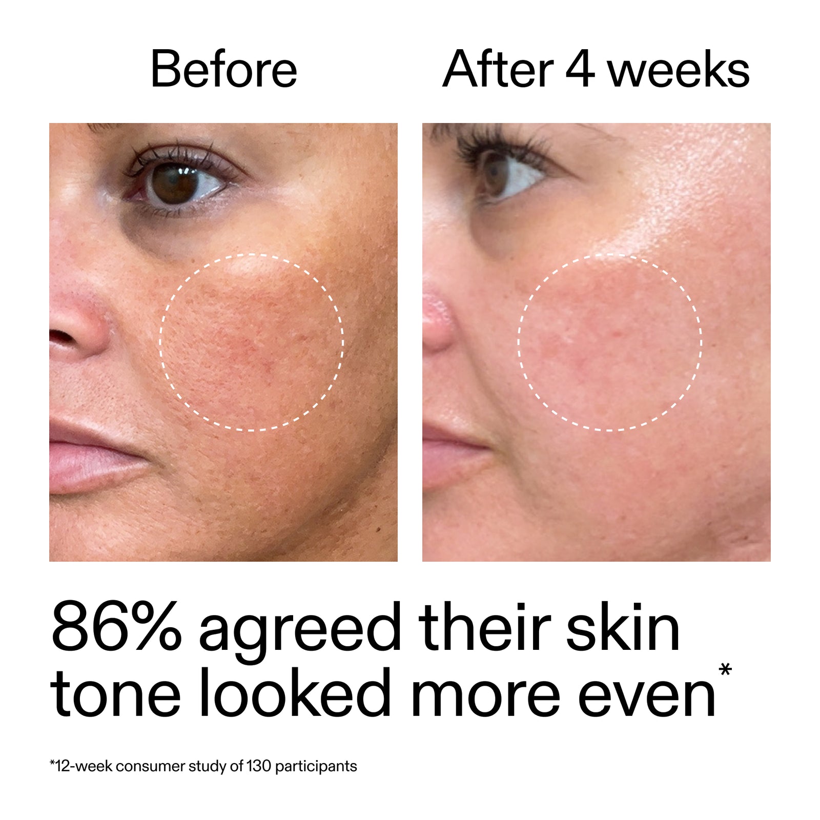 Before and after comparison of skin tone with text indicating improvement and study results.