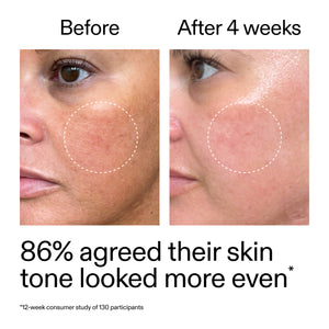 Before and after comparison of skin tone with text indicating improvement and study results.