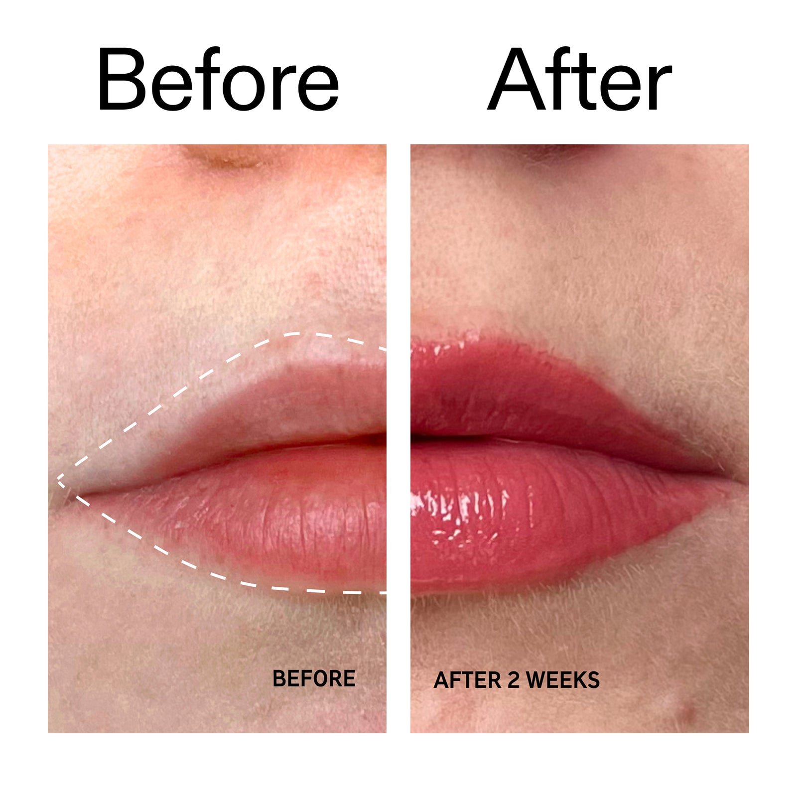 Before and after comparison of lips with a product application, showing a visible improvement.