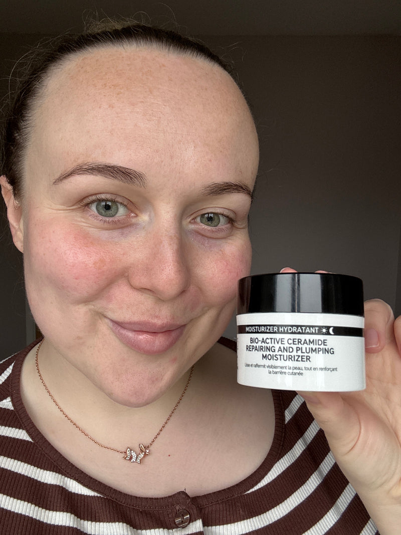 A woman holding a jar of Bio Active Moisturizer next to her face, wearing a brown and white striped top.