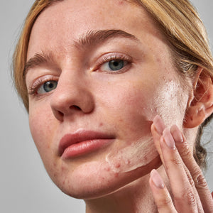Female model applying Blemish Clearing Moisturizer to her face