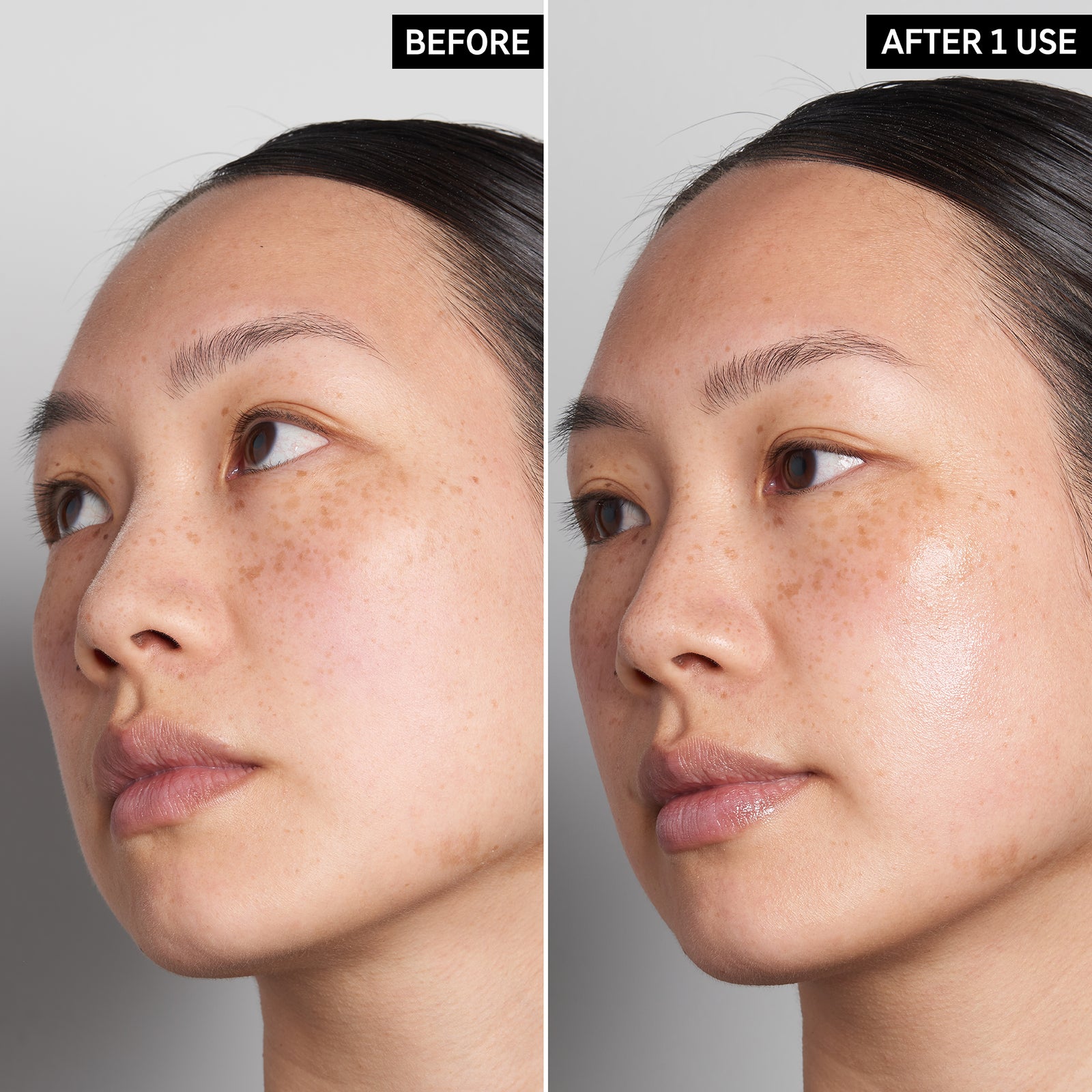 Two images of a model's face to show before and after using Supersize Hyaluronic Acid Serum just once