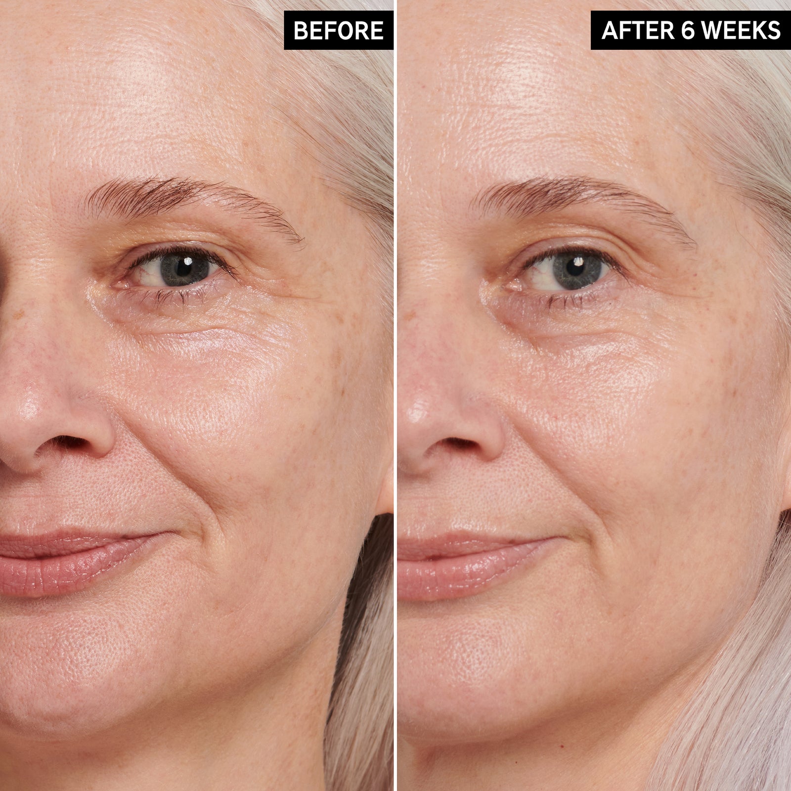 Before and after images side by side from results using Retinol Eye Cream